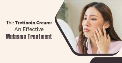 Tretinoin Cream: An Effective Way Of Melasma Treatment